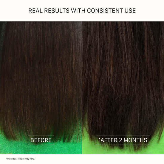 Before and after comparison of hair treatment results with consistent use, showing a significant improvement in hair health.